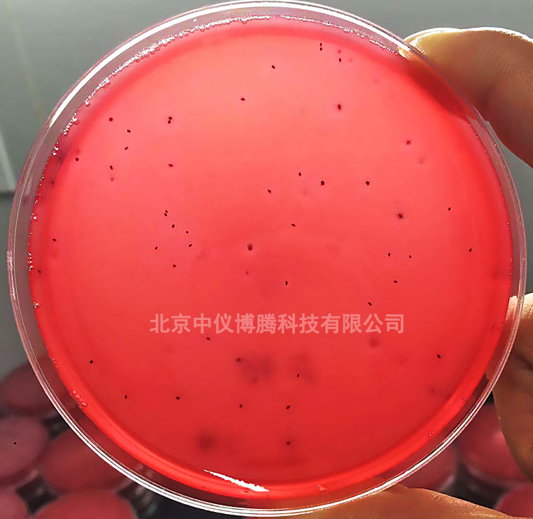 菌落总数的检测方法